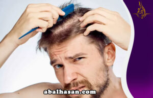 اسباب تساقط الشعر- طرق علاج تساقط الشعر