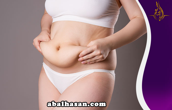 عمليات التجميل ترهلات البطن