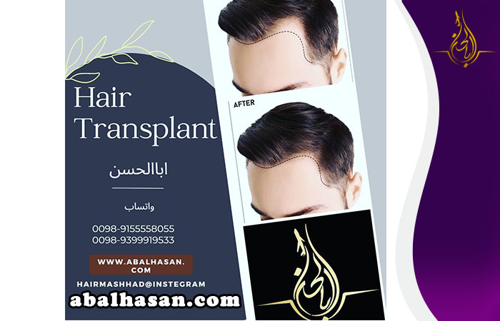 بكج زراعة الشعر في مشهد