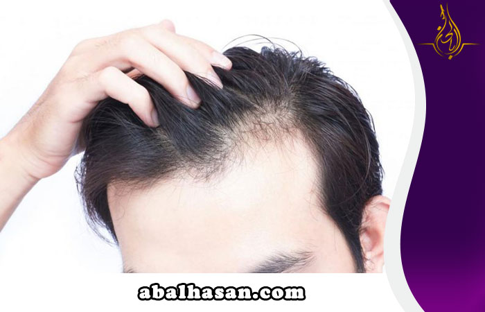 هل تعاني من الصلع أو فقدان الشعر؟
