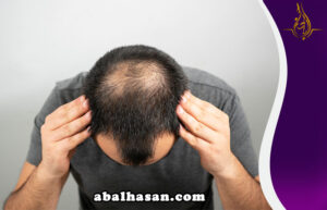 هل تعاني من الصلع أو فقدان الشعر؟