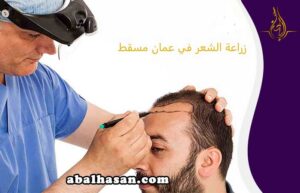 زراعة الشعر في مسقط