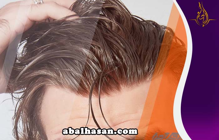 تجربتي مع زراعة الشعر الصناعي