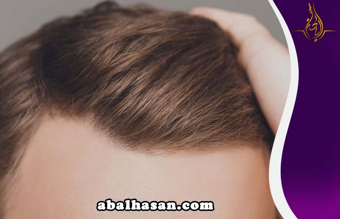 زراعة الشعر بتقنية DHI الكويت