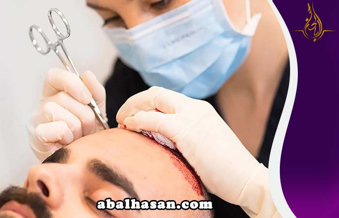 زراعة الشعر في ايران مدینة مشهد