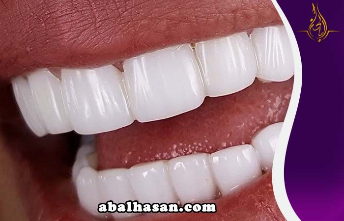 سیراميك الاسنان في البحرين