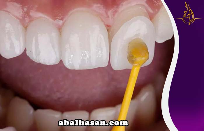 سيراميك الاسنان البحرين