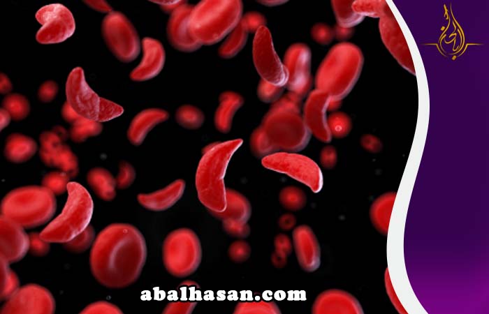 علاج فقر الدم المنجلي في البحرين